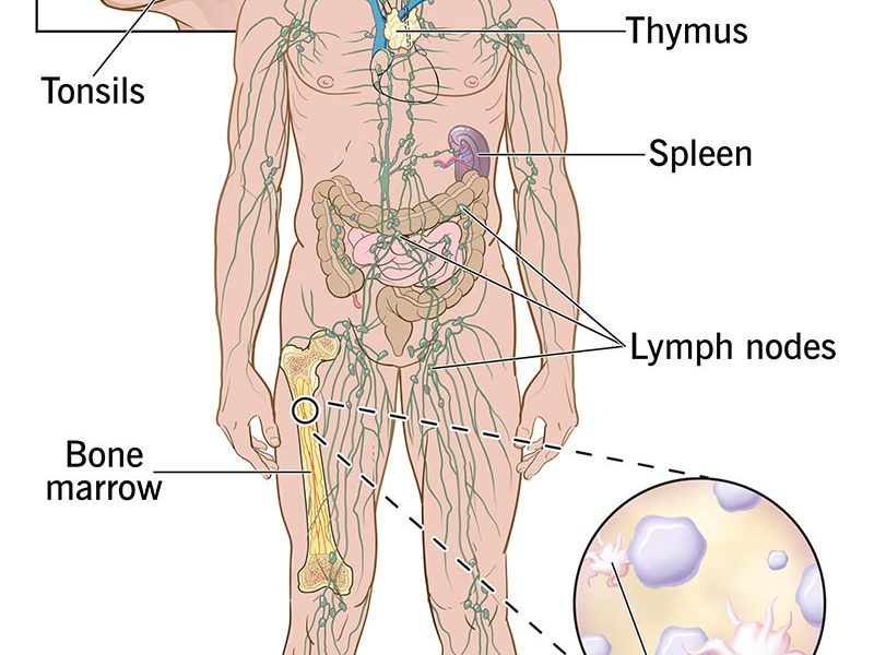 Immunity बढ़ाने के उपाय (Natural Ways to Boost Immunity)