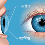 आंखों की रोशनी बढ़ाने के उपाय 2025