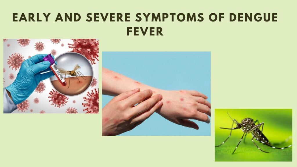 Early and Severe Symptoms of Dengue Fever
