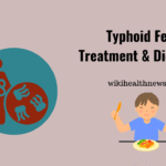 Typhoid Fever Treatment: Best Antibiotics and Latest Guidelines (2025)