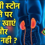 किडनी स्टोन में क्या खाएं और क्या न खाएं